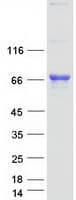 Human TDP1 Protein (Recombinant Myc-DDK (Flag))