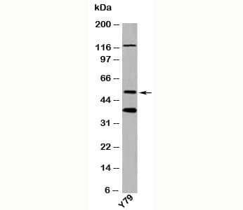 TXNIP Antibody (N-Terminus)