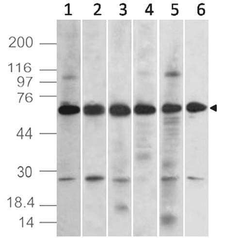 Monoclonal Mouse anti-Human TEM7 Antibody (WB)