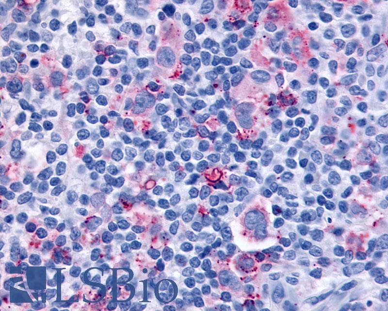 IHC-plus™ CYSLTR1 / CYSLT1 Antibody (C-Terminus)