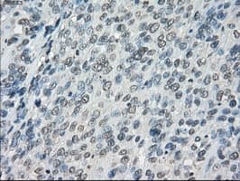 FCGR2 / CD32 Antibody (clone OTI19C10)