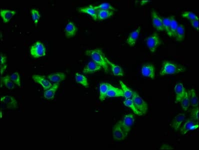 Polyclonal Rabbit anti-Human IL22RA1 / IL22R Antibody (aa250-573)