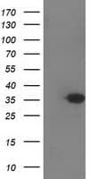SULT1C2 / Sulfotransferase 1C2 Antibody (clone OTI6F2, Carrier-free)