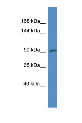 ADAMTS6 Antibody (aa848-897)