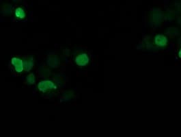 SSX1 Antibody (clone OTI1E10)