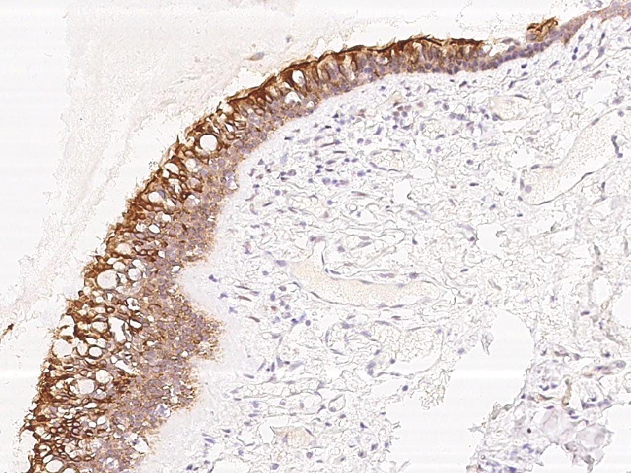 TMEM231 Antibody