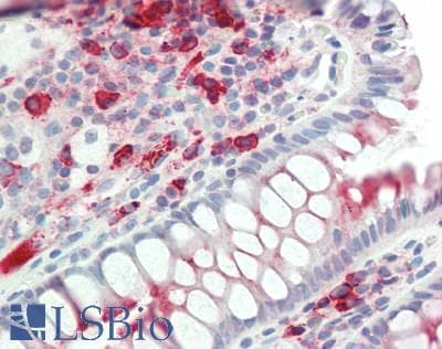 IHC-plus™ CSF1 / MCSF Antibody (C-Terminus)