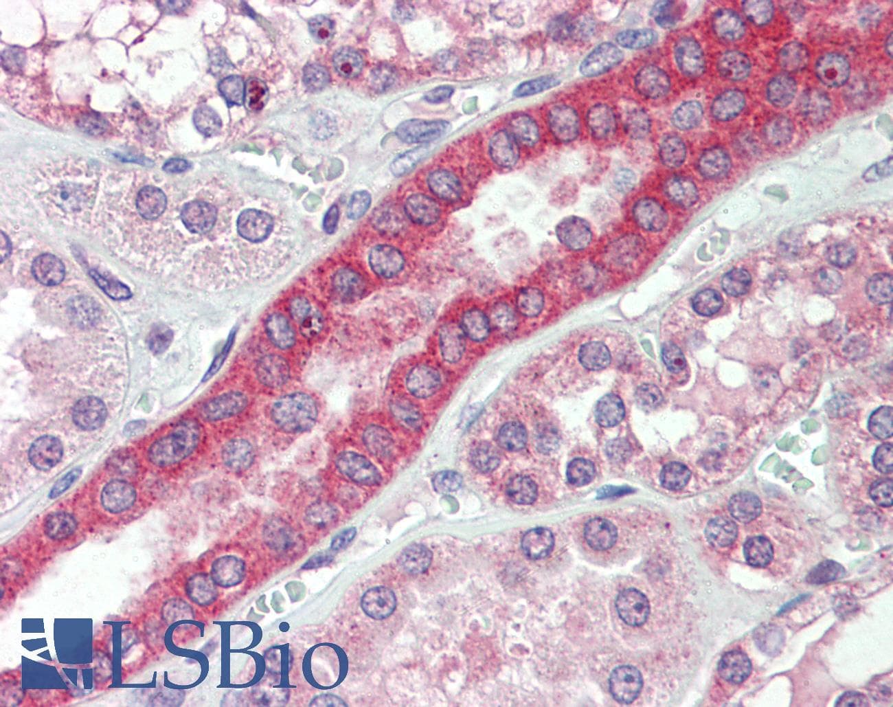 IHC-plus™ MYO1H Antibody (aa1002-1014)