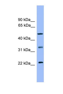 Polyclonal Rabbit anti-Human RAB8B Antibody (C-Terminus, WB)