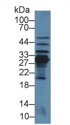 CRP / C-Reactive Protein Antibody (aa20-230)