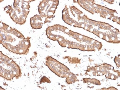VIL1 / Villin Antibody (aa179-311, clone rVIL1/1325, Azide-free, Carrier-free)