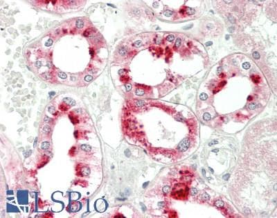 IHC-plus™ REN / Renin 1 Antibody (aa131-406, clone 1D3)