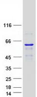 Human KATNAL1 Protein (Recombinant Myc-DDK (Flag))