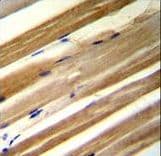 Polyclonal Rabbit anti-Human FAM207A Antibody (aa146-174, IHC, WB)