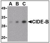 IHC-plus™ CIDEB Antibody