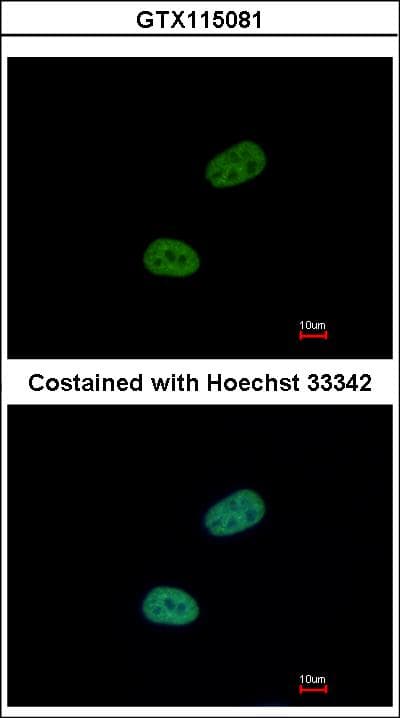 SRPX Antibody (aa231-464)