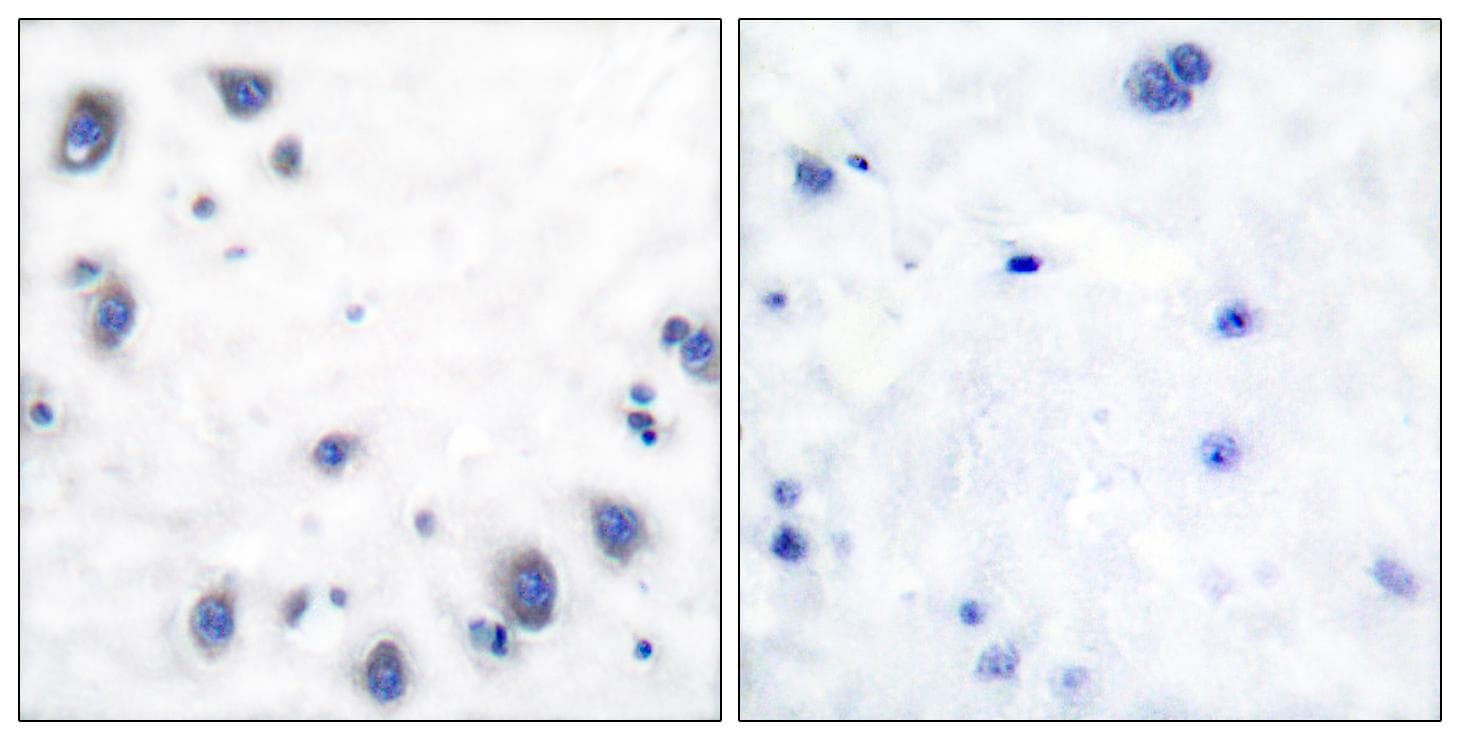Polyclonal Rabbit anti-Human TH / Tyrosine Hydroxylase Antibody (p40, IHC, IF, WB)