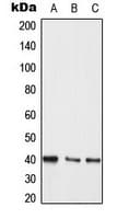 Polyclonal Rabbit anti-Human MEK3/6 Antibody (Internal, IHC, IF, WB)