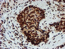 Monoclonal Mouse anti-Human PADI4 / PAD4 Antibody (clone OTI4H5, IHC, IF, WB)