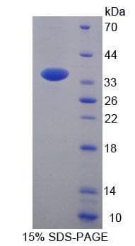 Human ACAA2 Protein (Recombinant His-T7, N-terminus)
