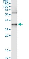 ANXA3 / Annexin A3 Antibody (clone 1E2)
