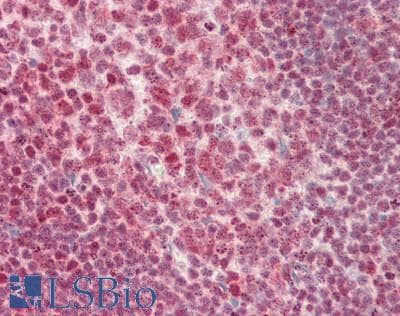IHC-plus™ Polyclonal Rabbit anti-Human ZMYM2 / RAMP Antibody (aa1327-1377, IHC, WB)