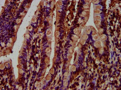 Polyclonal Rabbit anti-Human MCC Antibody (IHC, IF)