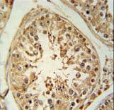 ZBTB5 Antibody (aa178-206)