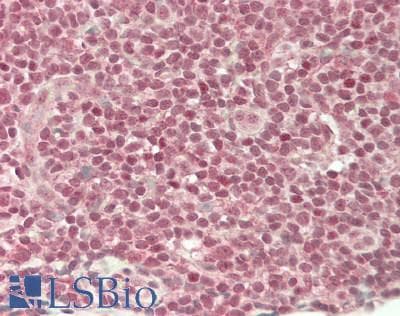 IHC-plus™ ZEB1 / AREB6 Antibody (aa850-900)
