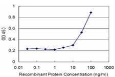 IHC-plus™ Monoclonal Mouse anti-Human SMAD6 Antibody (clone 1G2, IHC, WB)