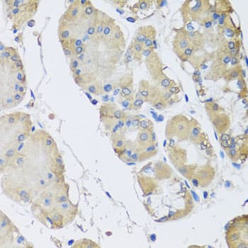 Polyclonal Rabbit anti-Human RPLP1 Antibody (IHC, IF, WB)