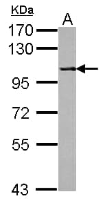 PPP4R1 / PP4R1 Antibody