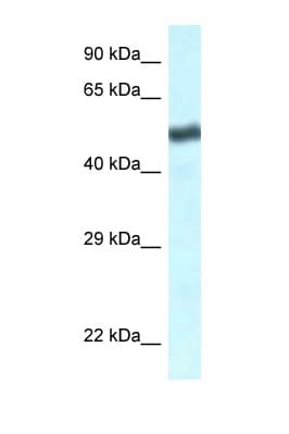 TBL1XR1 / TBLR1 Antibody (C-Terminus)