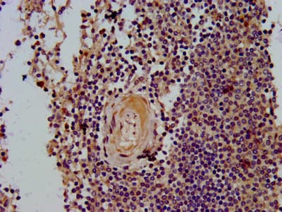 CLC Antibody