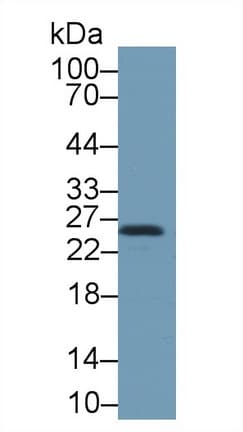 HSPB1 / HSP27 Antibody (aa1-209)