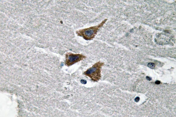 Polyclonal Rabbit anti-Human PLAU / Urokinase / uPA Antibody (aa190-239, IHC)