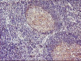 TMOD1 / Tropomodulin 1 Antibody (clone OTI2C2)