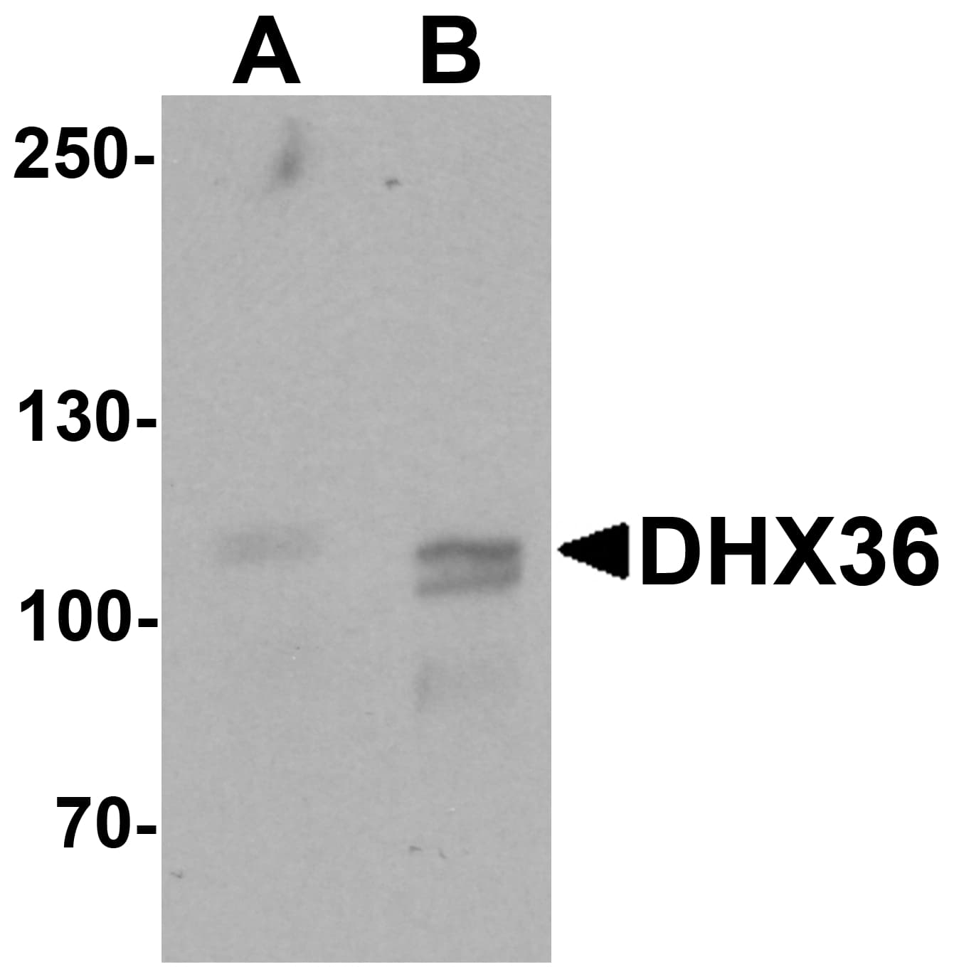 IHC-plus™ Polyclonal Rabbit anti-Human DHX36 Antibody (IHC, WB)
