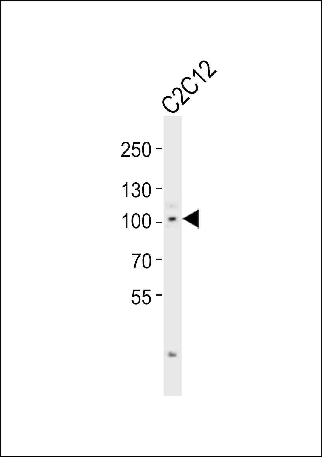 MYOCD / Myocardin Antibody (aa743-777)