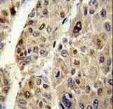 Polyclonal Rabbit anti-Human Antithrombin-III Antibody (aa364-393, IHC, IF, WB)