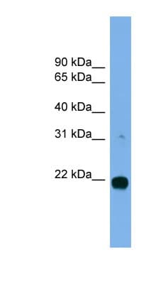MITD1 Antibody (aa71-120)