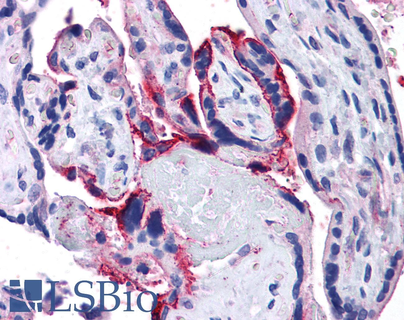 IHC-plus™ APH1A / APH-1 Antibody (aa58-70)