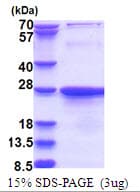 Human EXOSC1 / CSL4 Protein (Recombinant His)