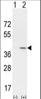 Polyclonal Rabbit anti-Human CCND1 / Cyclin D1 Antibody (aa147-175, WB)