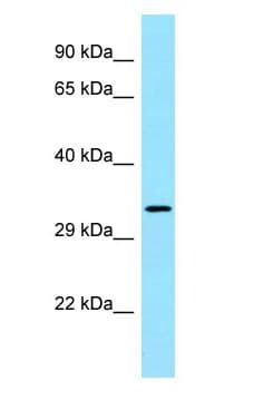 FGFR1OP2 Antibody (aa167-216)