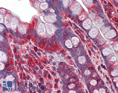 IHC-plus™ MYL12A / MRCL3 Antibody