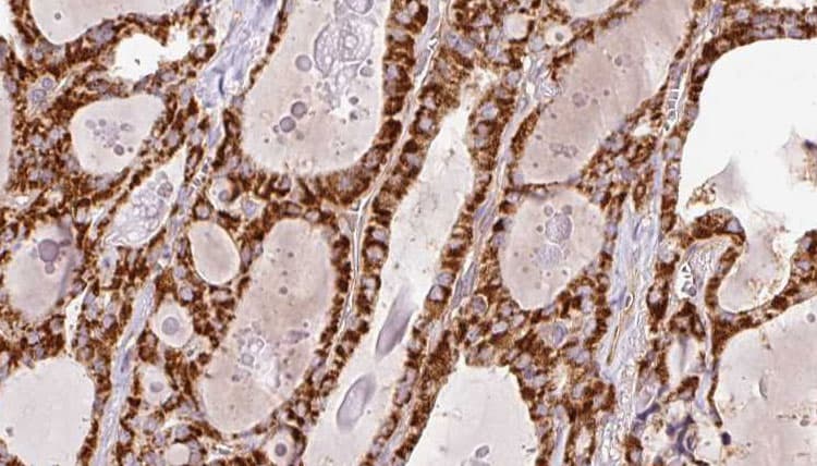 RYR2 / Ryanodine Receptor 2 Antibody