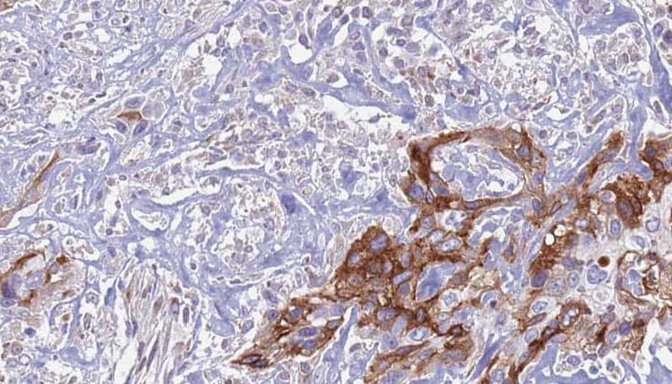 EPS8L1 Antibody