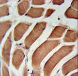SIKE1 Antibody (aa154-182)