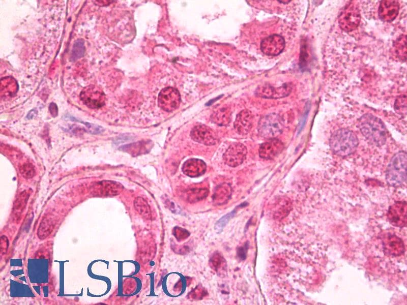 IHC-plus™ TCF7L2 / TCG4 Antibody (N-Terminus)